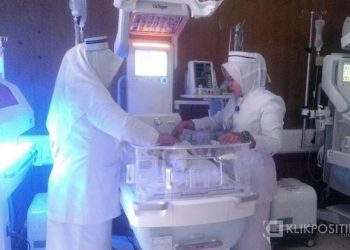 Almaira sedang menjalani perawatan di tabung inkubator