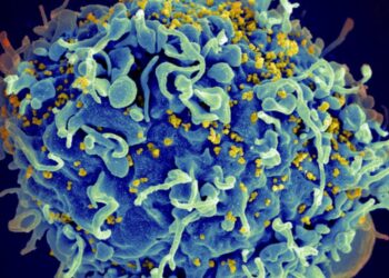sel T manusia (biru) sedang diserang oleh HIV (kuning)