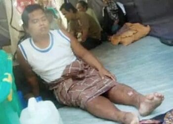 Ismael, warga Lubuak Laweh Padang Pariaman yang selamat dari Gempa Sumbar kendati sempat tertimbun longsor