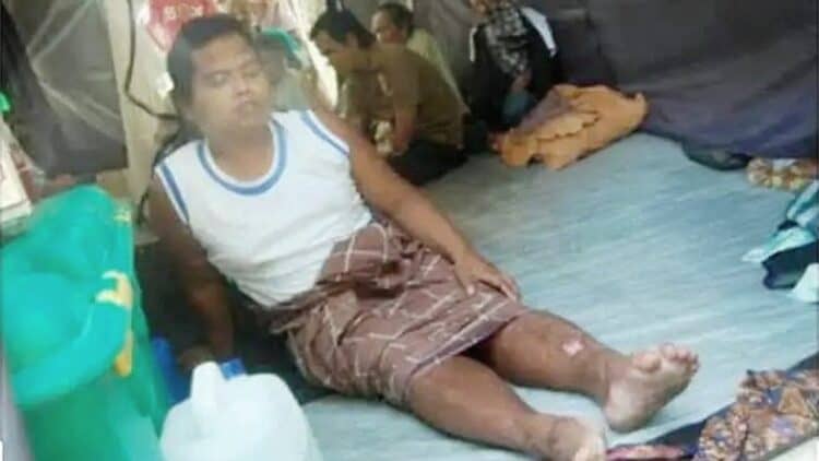 Ismael, warga Lubuak Laweh Padang Pariaman yang selamat dari Gempa Sumbar kendati sempat tertimbun longsor